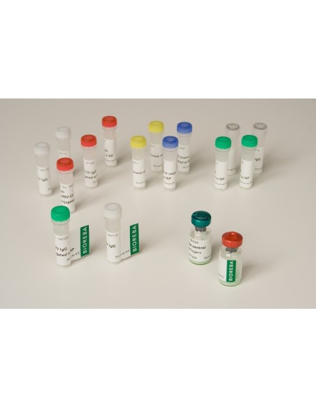 Apple stem pitting virus ASPV IgG 100 assays pack 0,025 ml